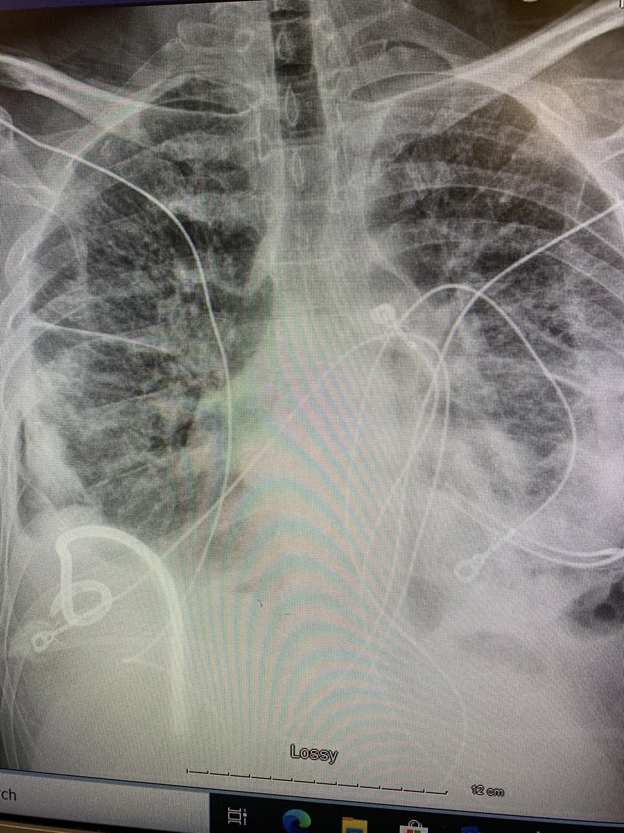 arun_chock's tweet image. #imageguided