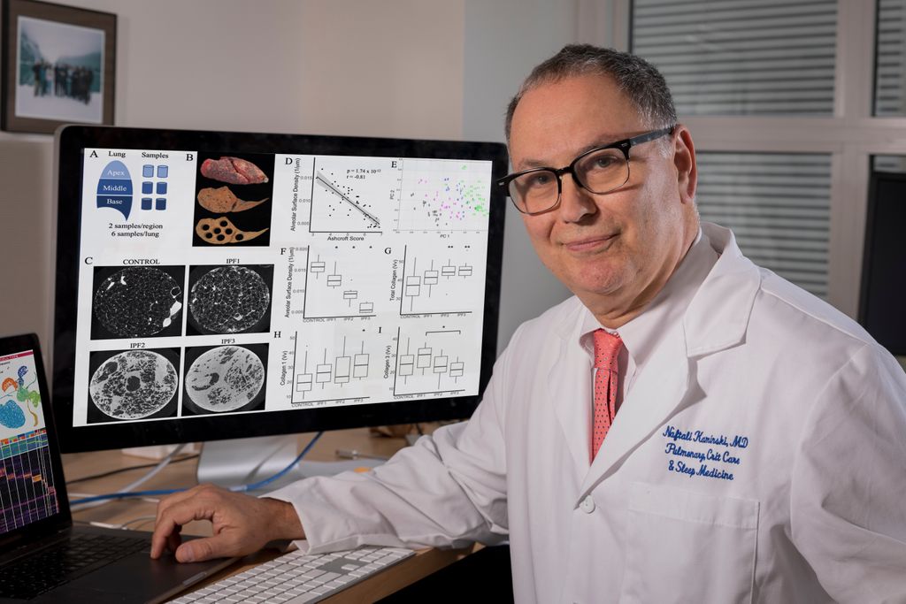 Yale Internal Medicine (@yaleimed) on Twitter photo "I usually tell our trainees we're privileged we can choose our profession & do things we love. We have a commitment to our patients & the truth" -<a href="/KaminskiMed/">Naftali Kaminski</a>
<a href="/YalePCCSM/">Yale PCCSM</a> Section Chief Naftali Kaminski, MD, gives pearls of wisdom on <a href="/MentorsMedicine/">The Medicine Mentors</a>
👂: themedicinementors.libsyn.com/overcoming-cha… "I usually tell our trainees we're privileged we can choose our profession & do things we love. We have a commitment to our patients & the truth" -<a href="/KaminskiMed/">Naftali Kaminski</a>
<a href="/YalePCCSM/">Yale PCCSM</a> Section Chief Naftali Kaminski, MD, gives pearls of wisdom on <a href="/MentorsMedicine/">The Medicine Mentors</a>
👂: themedicinementors.libsyn.com/overcoming-cha…