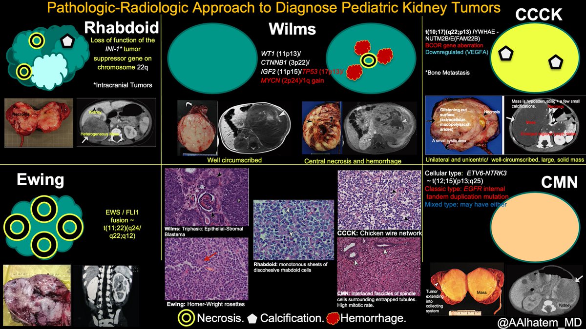 Giving a presentation to our residents, so I thought to share with #TwitterFamily the pathologic-radiologic approach to the diagnosis of pediatric kidney tumors &amp; some free points on the #boardexams #pathresidents. Pics source: Chung et al 2016 radiographics.rsna.org.