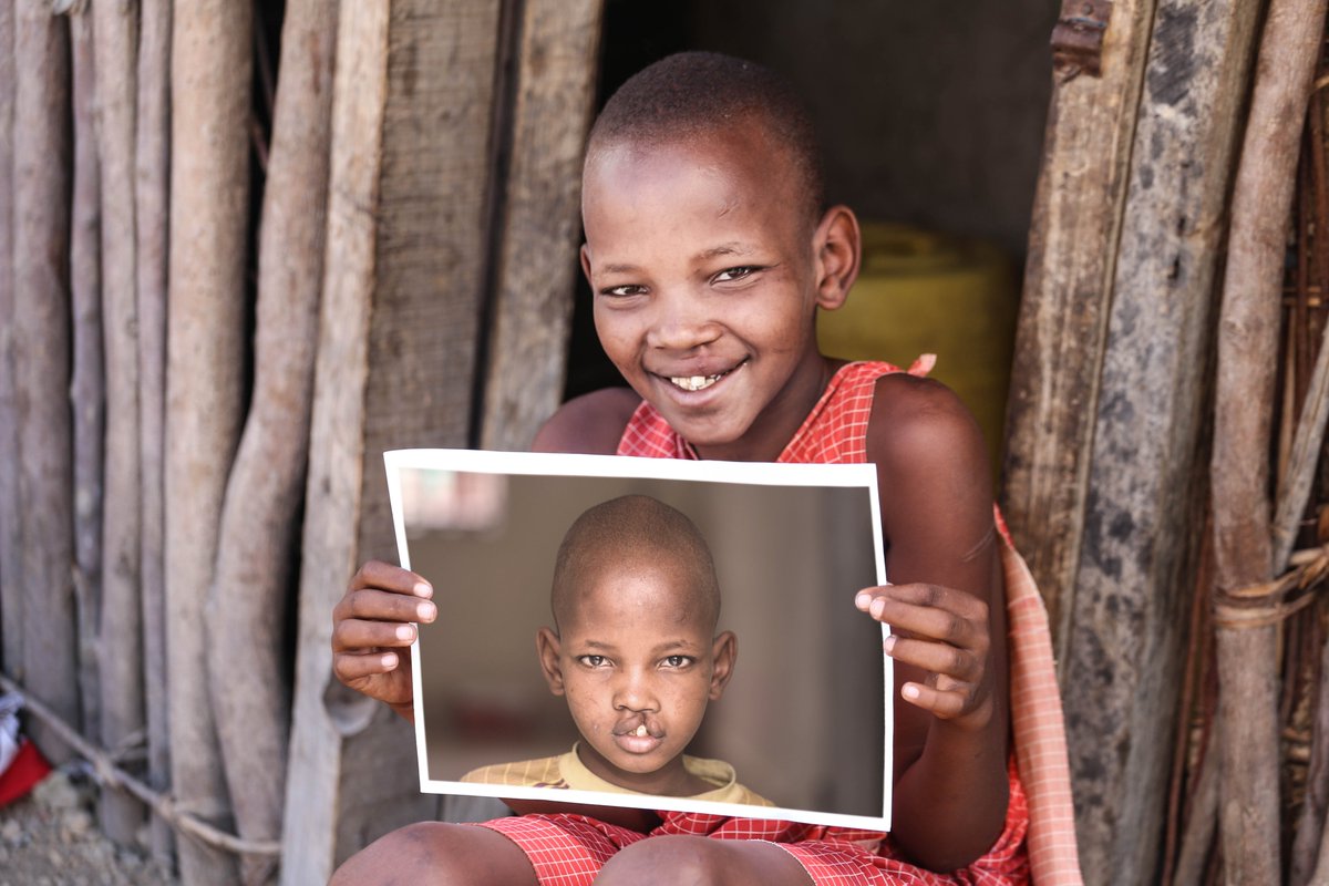 SmileTrainYLC's tweet photo. Check out our smile of the week from Kenya! https://t.co/3kjb7TaroG