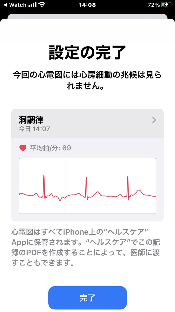 yokohama_A151's tweet image. アプデして早速試してみた！
#iOS14 #watchOS7  #心電図