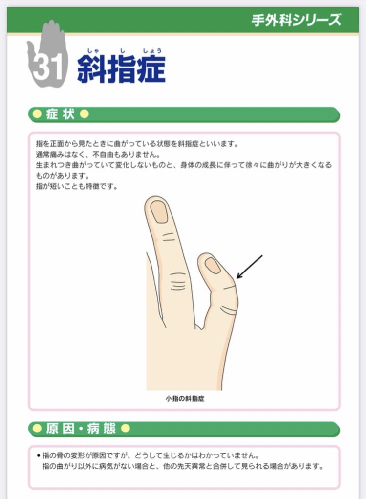 164 Auf Twitter 僕両手の小指が内側に曲がってるんだけど これ人間は皆こうだと思ってた 右手は割とギター弾くのに有利なんだよね 小指をピックガードに乗せる時めちゃくちゃジャストフィットするから 左手は不利ぽいけどこれが普通だと思って生きてきたから特に 164 Auf Twitter 僕両手の小指が内側に曲がってるんだけど これ人間は皆こうだと思ってた 右手は割とギター弾くのに有利なんだよね 小指をピックガードに乗せる時めちゃくちゃジャストフィットするから 左手は不利ぽいけどこれが普通だと思って生きてきたから特に