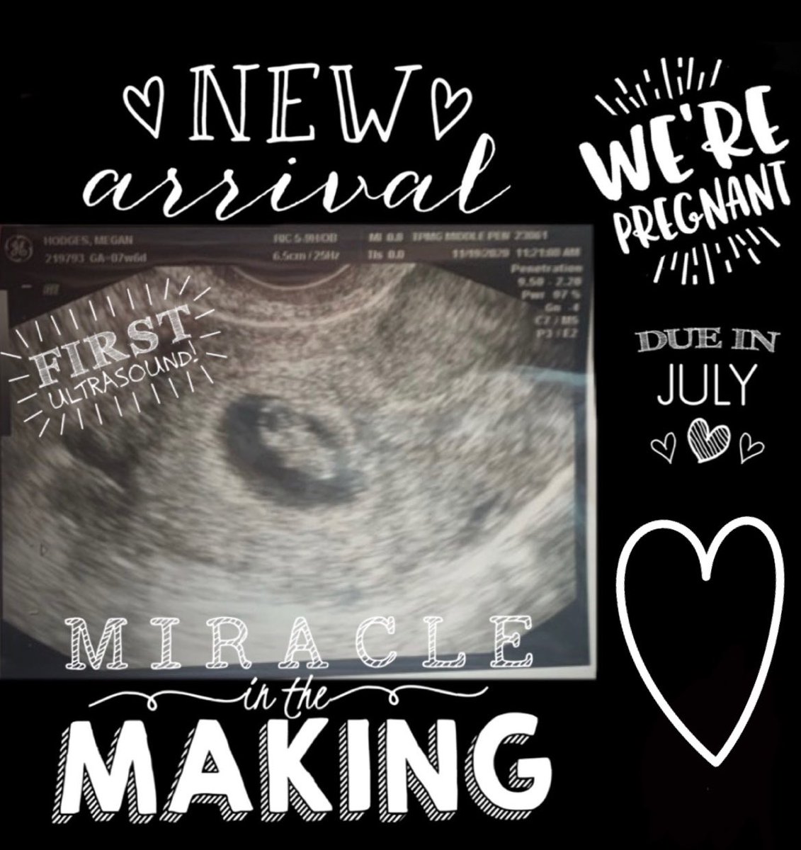 mhodgessss's tweet photo. Update: I am with child 🤰🏻 https://t.co/luKqDL5K09