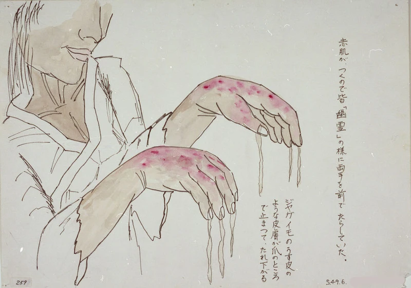 Matsumuro Kazuo. To prevent their red, exposed flesh from sticking, people thrust their arms in front of them like ghosts. Their skin, like the thin skin of potato, hung from the fingernails, where it was still attached.