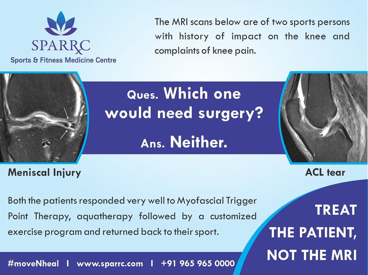 sparrcinstitute's tweet photo. Treat the patient, not the MRI.
For surgeryless treatment, call 9659650000.
#surgeryless #avoidsurgery #moveNheal #kneesurgery #avoidaclreconstruction #avoidmeniscalsurgery #meniscalsurgery #aclsurgery #acl #acltear #aclrehabilitation #myofascial #myofascialreleasetherapy https://t.co/sgZECQo08p