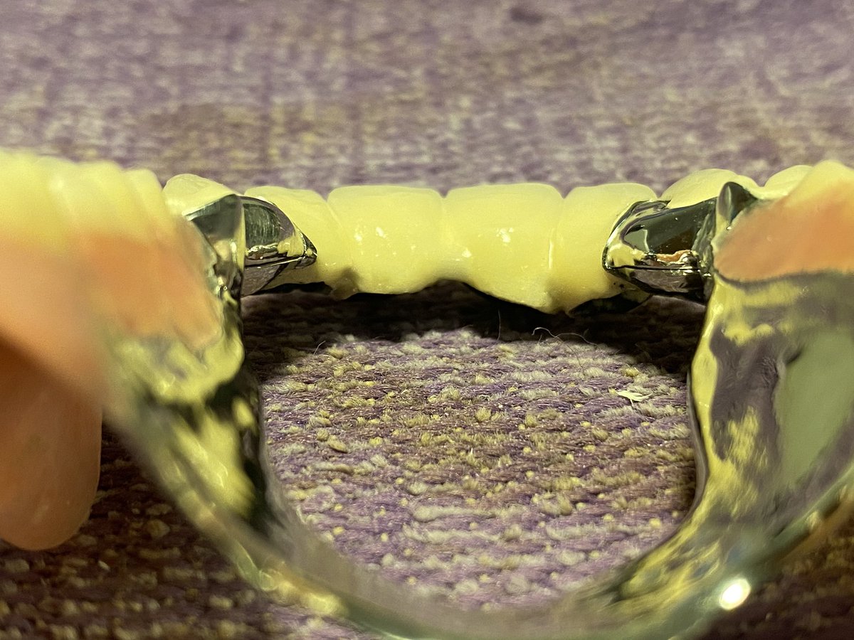 Dixy900920's tweet photo. Partial-framework designed wit Exocad 💪 #3dmodeling #3Dprinting #ExoCad #dentaltech #partialframework https://t.co/zxEF1wYsA7