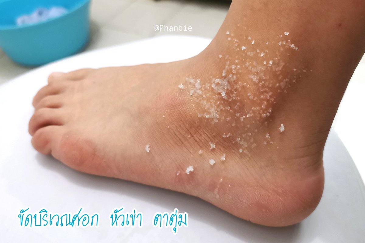 Phanbie's tweet image. ปกติชอบใช้​ Garnier​ วิตามินC เซรั่ม​  อยู่​แล้ว​​ ใช้ละหน้าผ่องมาก​ จุดดำจางลงเยอะ​ นี่เลยเอามาทาตาตุ่ม เอาเซรั่ม​ผสมกับเกลือ​ แล้วถูตรงที่คล้ำๆ​ พวกศอก​ หัวเข่า​ ตาตุ่ม​แบบขาววขึ้นนและเนียน​ขึ้นอ่ะ ทำแบบต่อเนื่อง ใสเฉย เริ่ดมาก​ #ใช้ดีบอกต่อ