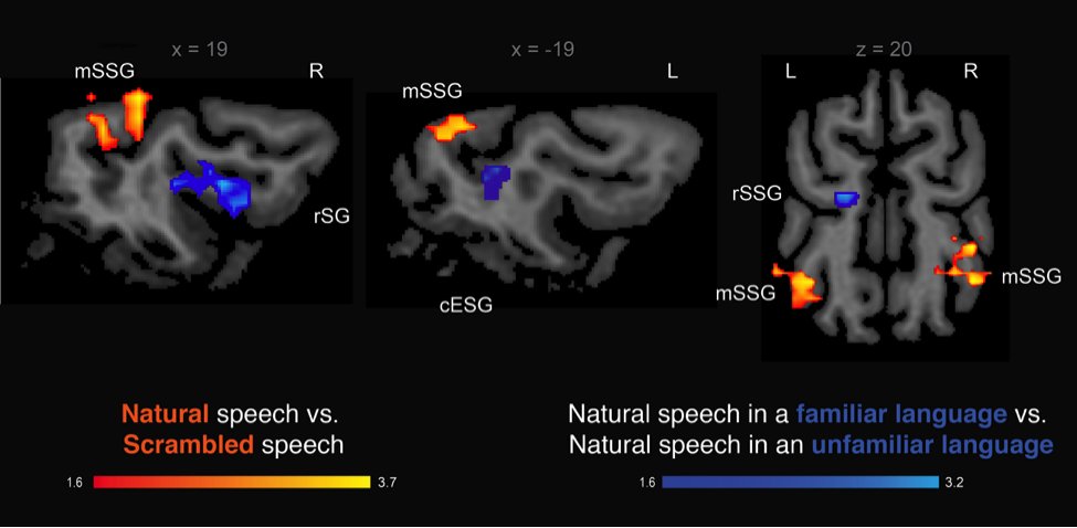 4/6 Using  #MVPA, we found that the primary auditory cortex discriminates between speech and scrambled stimuli, independently of language. While the secondary auditory regions discriminate between both languages but not between the scramble stimuli ones.  #AnimBehav2021
