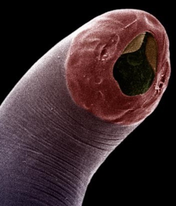 Heres the story of how I volunteered to be infected with 50 parasitic worms (hookworm) for a year as part of a research study. Check out this thread & follow me for more  #parasite & marine biology content [t] #ScienceTwitter imgs:  https://bit.ly/39FDQNe   https://n.pr/3itKXwk 