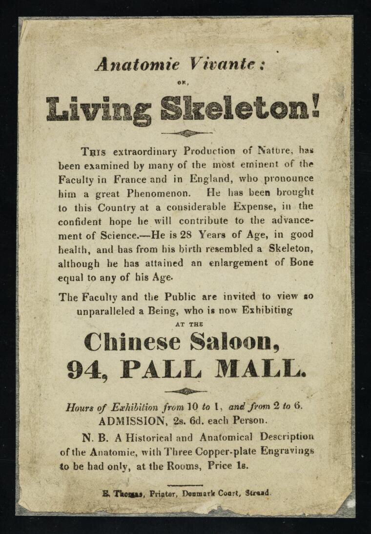 Searching the Wellcome Collection, I came across this poster advertising the appearance of The Living Skeleton - Anatomie Vivante! - at the Chinese Saloon in Pall Mall, c.1825. It intrigued me. Was this animatronics or puppetry? No, it turned out to be much worse...
