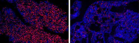 CIRMnews's tweet photo. DNA therapeutic treats blood cancer in mice and begins human clinical trial @ionispharma @UCSDHealth @UCSDMedSchool
Read more about it here: https://t.co/FT5bY13XQH https://t.co/Y4CUIJvns0