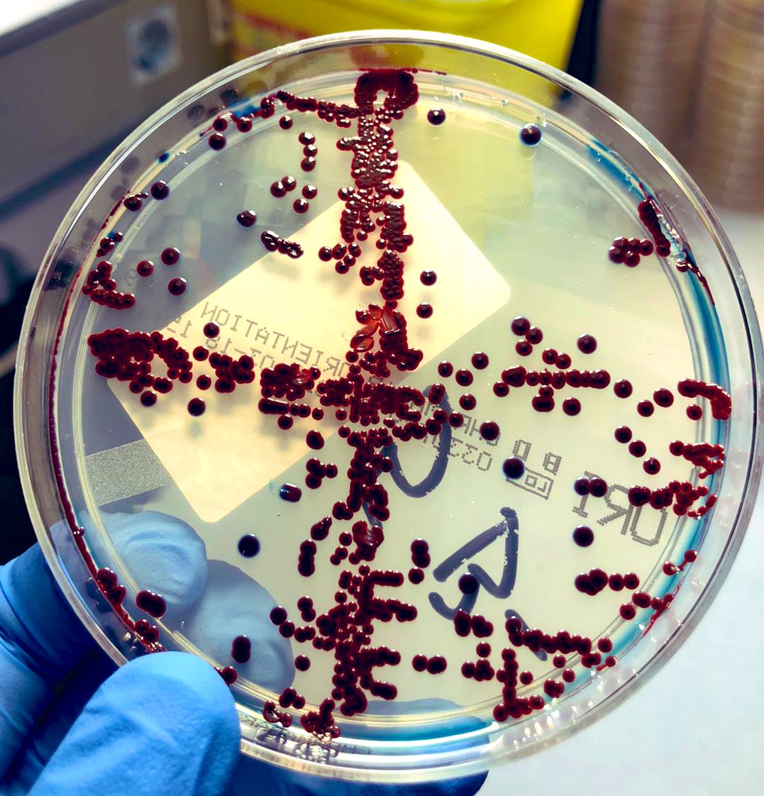 #Serratia marcescens haciendo honor a su apellido 🔥. Las cepas clínicas (como esta de obtuvimos de urocultivo) rara vez presentan el pigmento #prodigiosina, cuyo vivo color rojo sangre ha dado lugar a curiosas anécdotas a lo largo de la Historia.