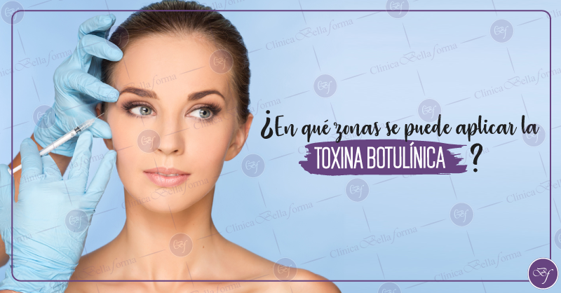 bellaforma_peru's tweet photo. Las zonas de aplicación de la toxina botulínica son: frente, entrecejo y patitas de gallo. Este tratamiento te ayuda a contraer temporalmente el tejido muscular para controlar la flacidez.
Solicita  tu cita gratuita: https://t.co/71IKcJ2SF8 https://t.co/kXFEQXlLy1