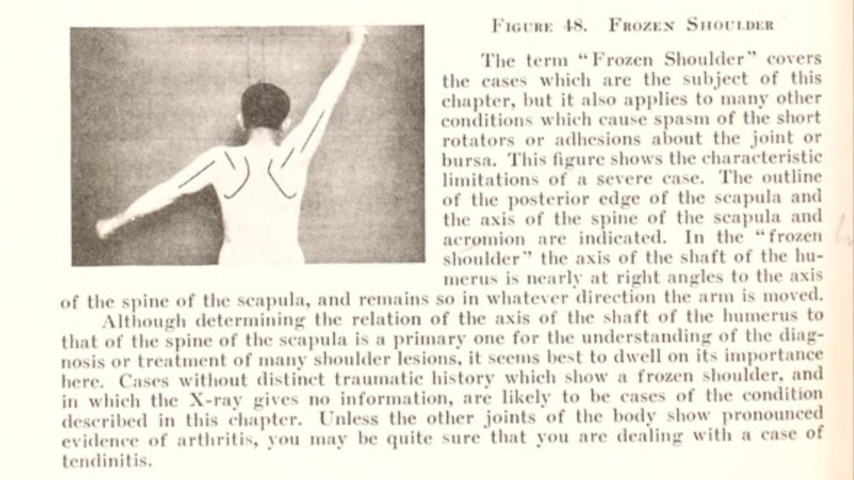 And then we get onto his observations and thoughts about the enigma that is frozen shoulder...