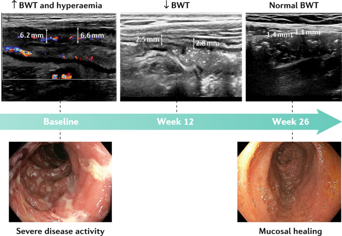 Nature Reviews Gastroenterology & Hepatology tweet media