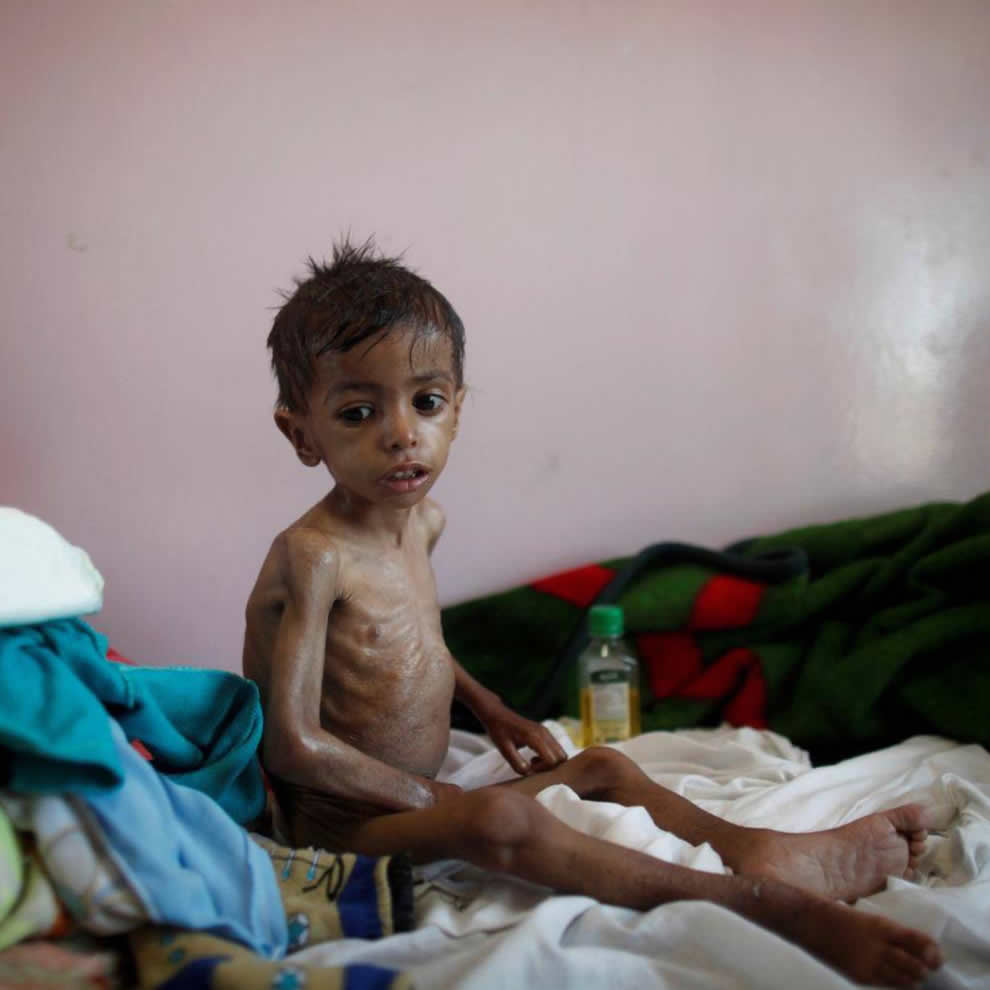 6. When we say "Never Again", we need to mean it.Right now, the Pentagon is funding and arming a Saudi-led genocide against the people of Yemen. 100s of thousands have already died, mostly from starvation.Obama started it.Trump expanded it.Biden needs to end it.