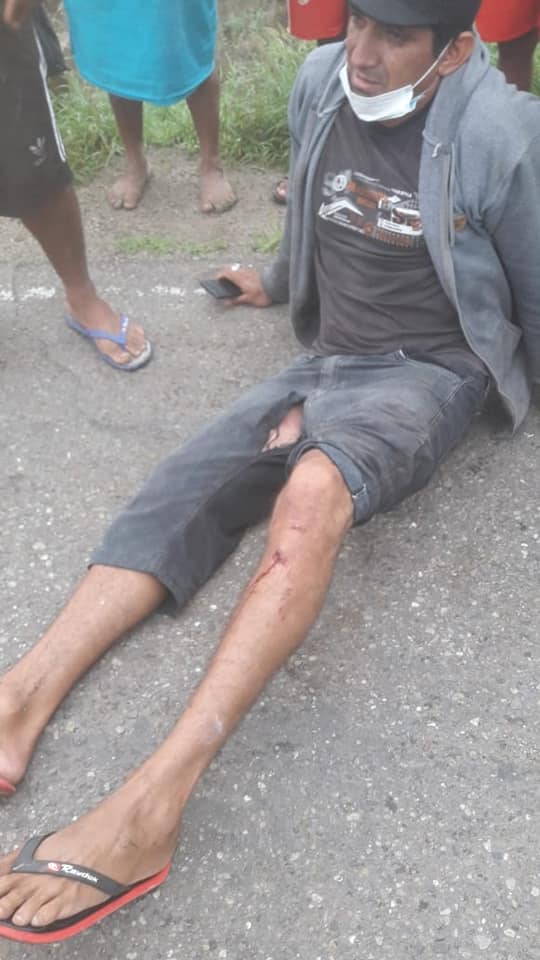 TUMBES21's tweet photo. UN HERIDO DEJA CHOQUE DE VEHÍCULOS PESADOS EN ZARUMILLA

El choque entre un volquete y un camión dejó  un herido en el caserío Cuchareta Alta de la provincia de Zarumilla, el hecho ocurrió hoy a las 7:00 de la mañana. el herido responde al nombre de Darwin Zapata Gonzales. https://t.co/JdW3dKWapJ