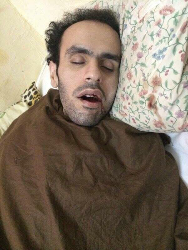 In 2013, I was jailed in Egypt on bogus charges for live tweeting protests against the coup. I was tortured, kept in solitary confinement & made to live in conditions no human ever should. I nearly died more times than I can recallRob was a Senior WH official at the time!