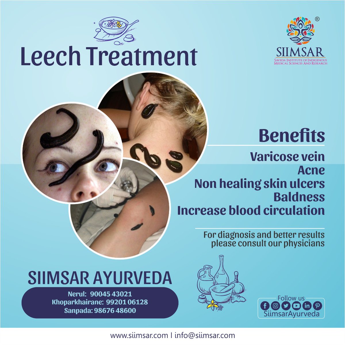 By sticking a leech on soft tissue target of disorder, the saliva it releases makes the patient's blood thinner for smooth circulation. It removes clotted blood. Best for #Varicosevein #Acne #Skinulcers #Baldness. Call us on +91 9326721112 to book an appointment. #leechtreatment