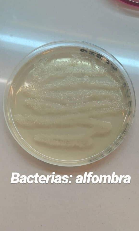 mICROBIOsh's tweet image. 🧫Mira los microorganismos con las que a diario convivimos y a simple vista no las vemos, pero siempre están ahí.