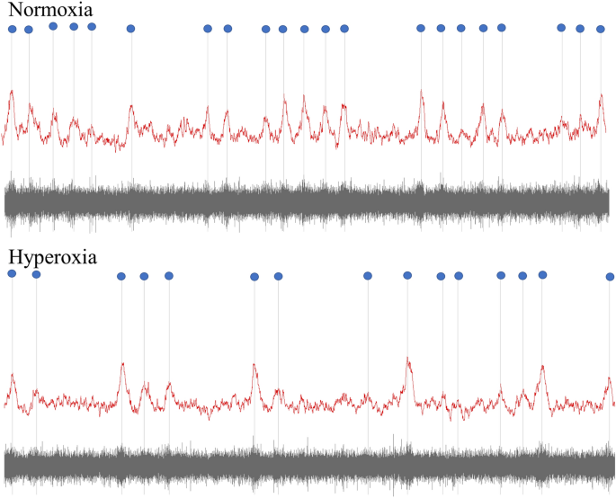 New article: Blunted sympathetic neurovascular transduction is associated to the severity of obstructive sleep apnea. By <a href="/CraigSteinback/">Craig Steinback</a> <a href="/Asteele941/">Andrew Steele</a> and colleagues. Read it here (free access): rdcu.be/ce9lF