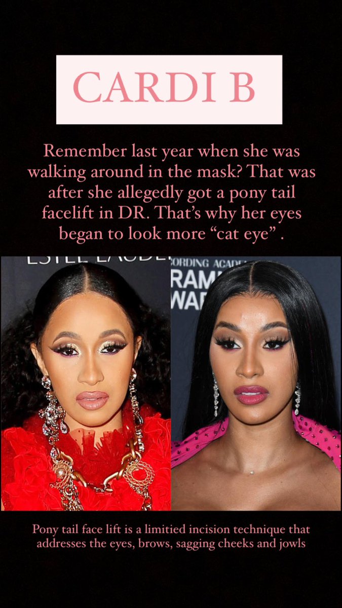 I suspected she did something to her eyes and I commented on it here and on IG . Her canthus was noticeably tilted up . ( Go read my eye thread) .... But then I also noticed the increased eyelid width and eyebrow positioning.