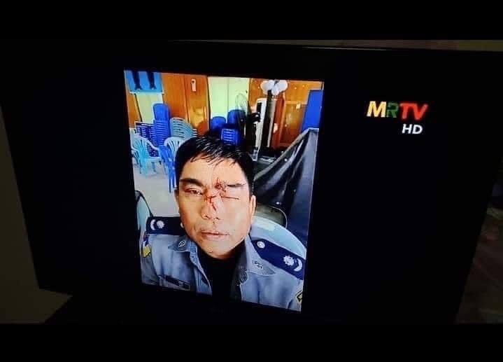 ‼️Fake News‼️ပြည်သူတွေကခံနေရတာပါနော်ခုပြထားတဲ့ရဲကသူ့ဘာသာပြည်သူပစ်ချင်လို့ချော်လဲပြီးထီးရိုးနဲ့ရိုက်မိတာပါပြီးသူတို့ချင်းချင်းပြန်တက်နင်းမိတာပါခုကမ္ဘာကိုလှည့်စားထားပါတယ်ပြည်သူတွေကလုပ်တယ်ဆိုပြီး