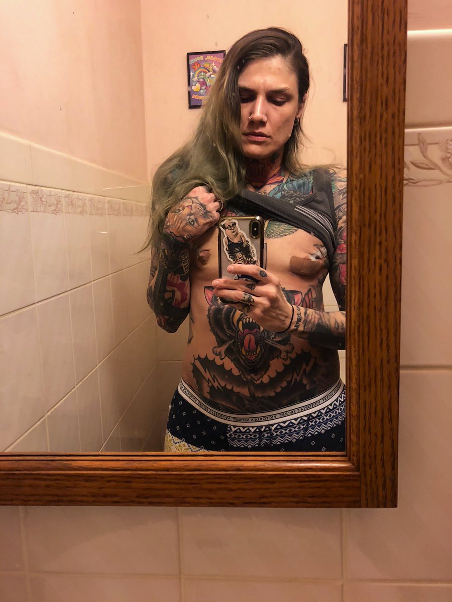 KarryKassi's tweet image. Start filling up expanders this week! Can’t wait! Thinking I may just get ahead of the chemo &amp;amp; shave my head. #fuckcancer #doublemastectomy #scars