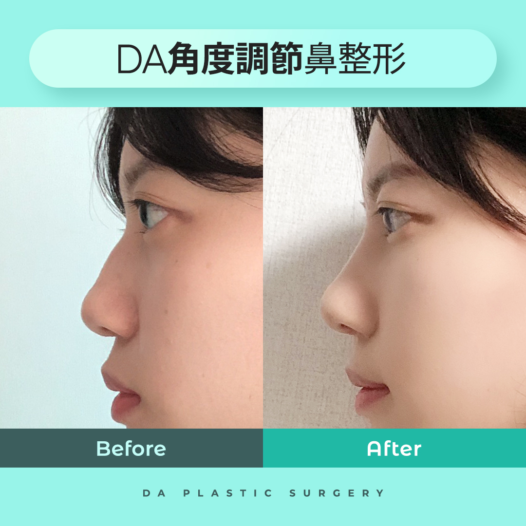 韓国整形ツアー