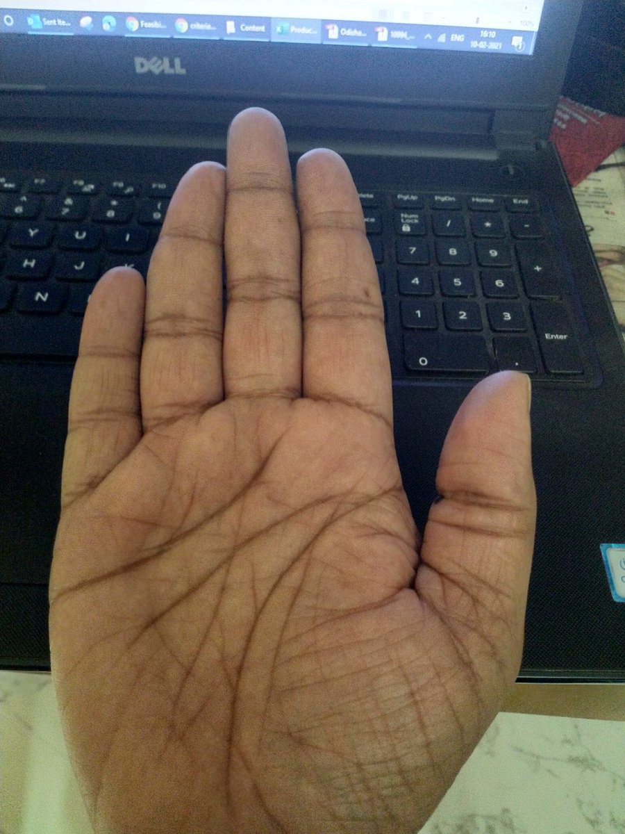 researchanand's tweet photo. #palmtwitter 

हातावरच्या रेषा बघितल्या की मुंबई लोकल ट्रॅक ची आठवण येते..😁😁

भविष्यात डोकावणार का कोणी??? https://t.co/wglaXLQnjH