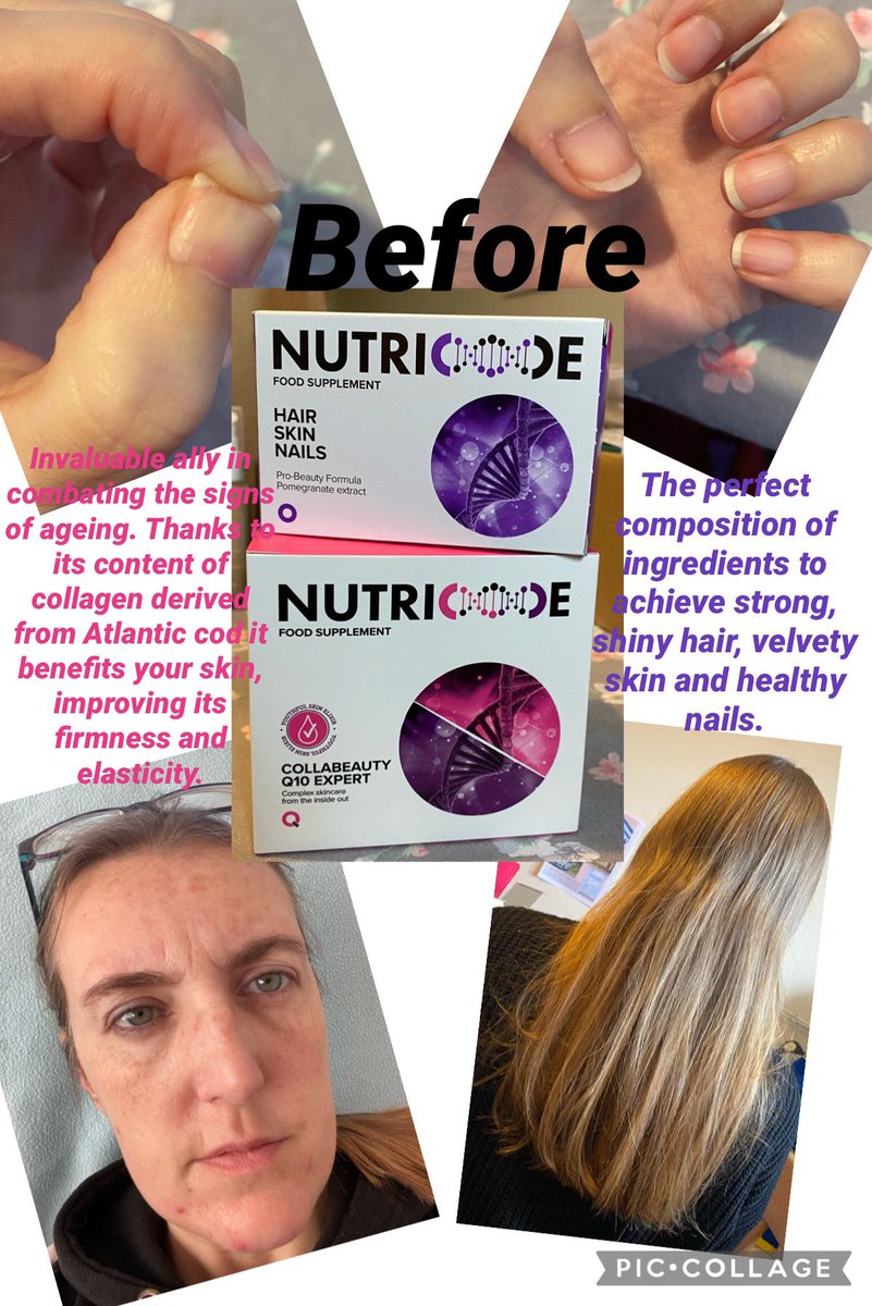 Amanda28_84's tweet photo. It’s a week ago tomorrow that I’ve been using this. Can’t wait to show you week 1 results. #hair #skin #nails #Q10 #collabeauty #nutricode https://t.co/FTvYK6AoJf