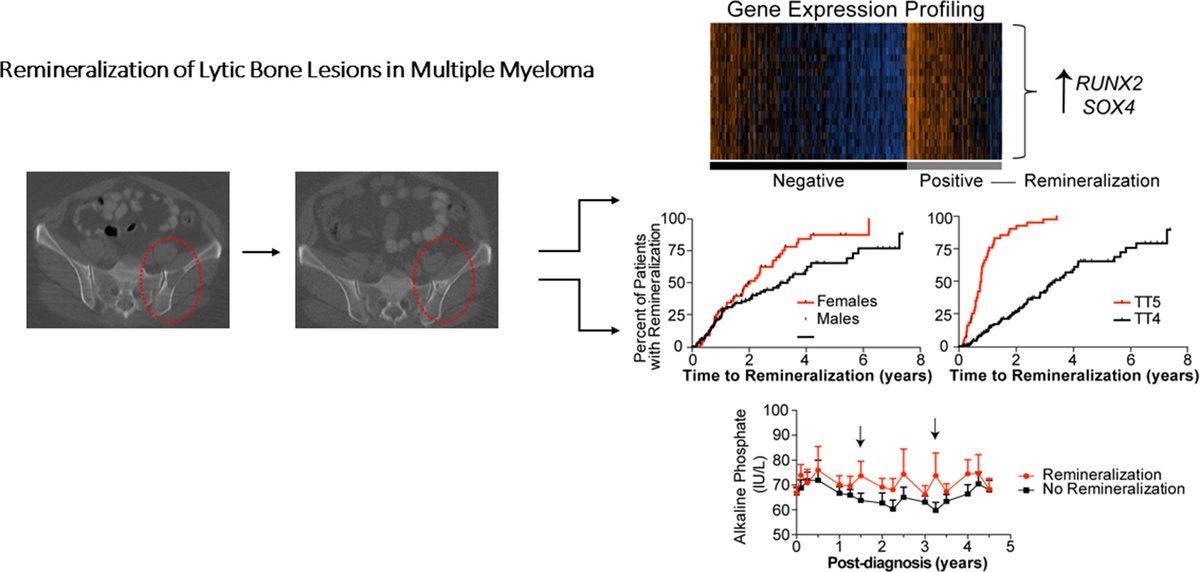 Bone remineralization Of Lytic Lesions in Multiple Myeloma --The Arkansas experience 
sciencedirect.com/science/articl… 
<a href="/UAMSMyeloma/">UAMS Myeloma Center</a> <a href="/shivdesai/">Shivang Desai</a> <a href="/shobhitsharma06/">Shobhit Sharma</a> <a href="/drrohansamant/">Rohan Samant</a> 
<a href="/Phari/">Phari</a> This calls for additional studies targeting sclerostin, DKK1, and TGFβ in MM bone disease