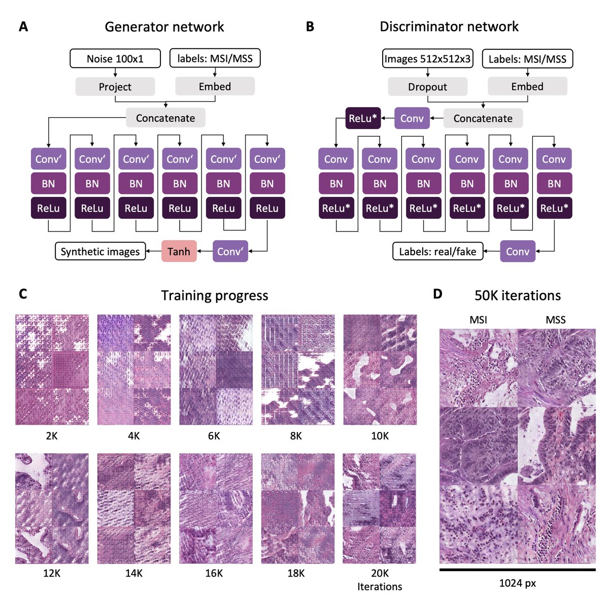 Our new paper is out in the Jnl of Pathology 🔬💻 "DL detects genetic alterations in cancer histology generated by adversarial networks" pubmed.ncbi.nlm.nih.gov/33565124/ We show that synthetic histology preserves molecular information. Project led by medical student <a href="/JeremiasKrause/">Jerry</a> 🧑‍💻👍