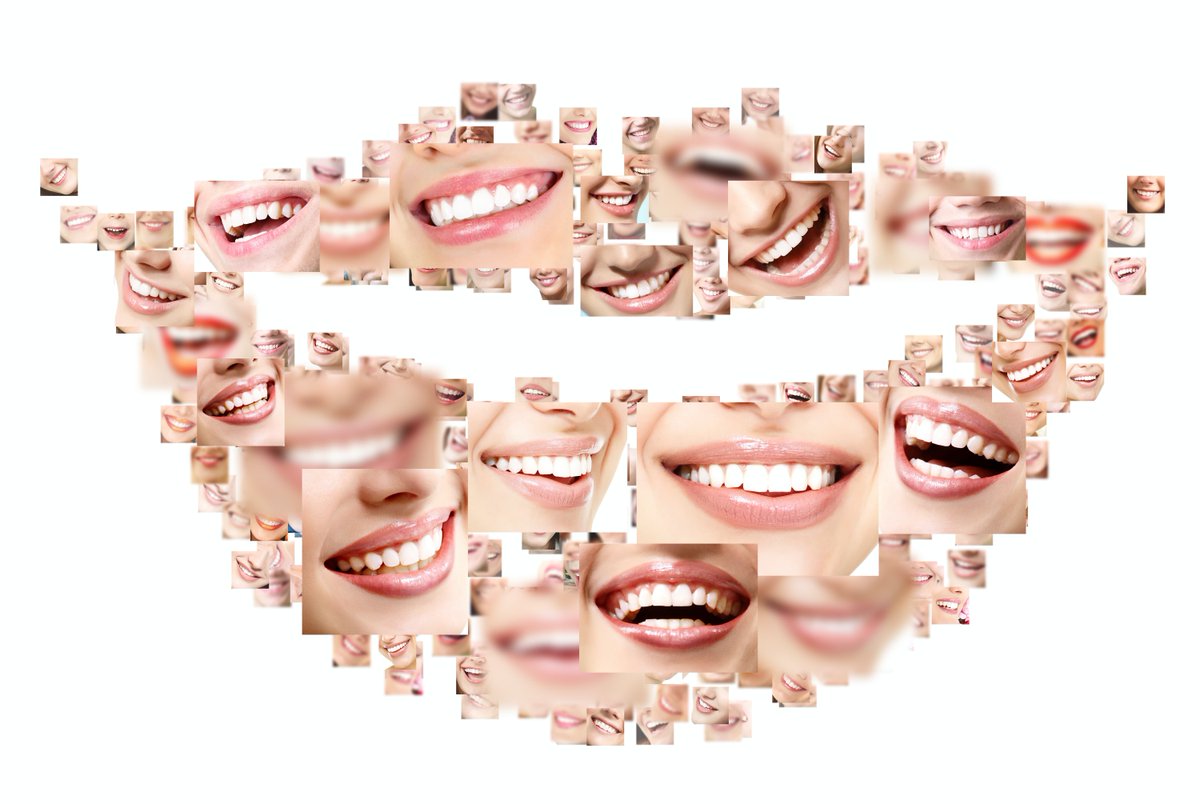 nvdentists's tweet photo. What's your dream smile look like?  Free consultations for Invisalign, Dental Implants and Full Arch Consultations.  Schedule today: https://t.co/IkoDZO3v6Y
#dentist #implantdentist #hybridge #invisalign #nvdentists https://t.co/qEdNgRTpz4