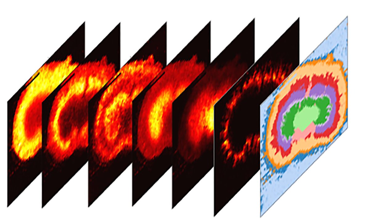 _hubmap's tweet photo. Here's #_hubmap's image of the week! This week is a collection of images from Julia Laskin's student Hang Hu that show new mathematical ways to present maps of #imagingmassspec data. Come back soon to see the article in Analytical Chemistry, #womeninscience @lifeatpurdue https://t.co/RbIoNZdyv9
