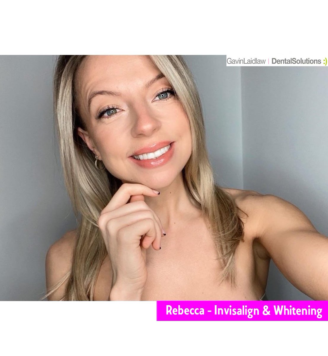 DentaISolutions's tweet photo. What a stunning result for Lauren's patient!
Rebecca has just completed #Invisalign &amp; #whitening, and we think her smile says it all!

Call us to book your #FreeConsultation to achieve the smile of your dreams. ⭐
#InvisalignUK #InvisalignSmile #smilegoals @Invisalign https://t.co/8Qo6KFoyC8