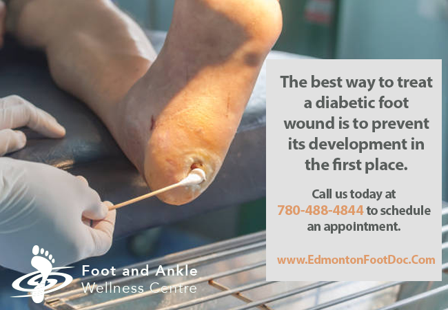 EdmontonFootDoc tweet picture