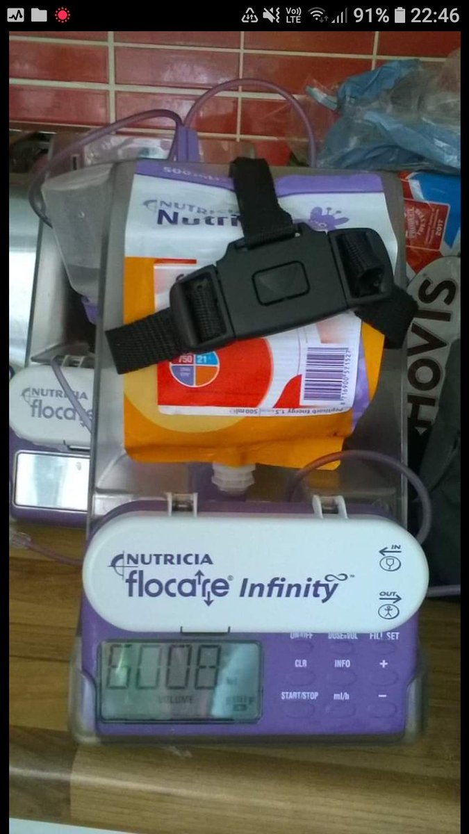 A variation on this is an NJ tube (NasoJejunal) up the nose, straight through the stomach and ending in the small intestine. Great for some, was very traumatic for us. Feeding must be slow and continuous, as the small intestine can't digest like stomachs can, so requires a pump.