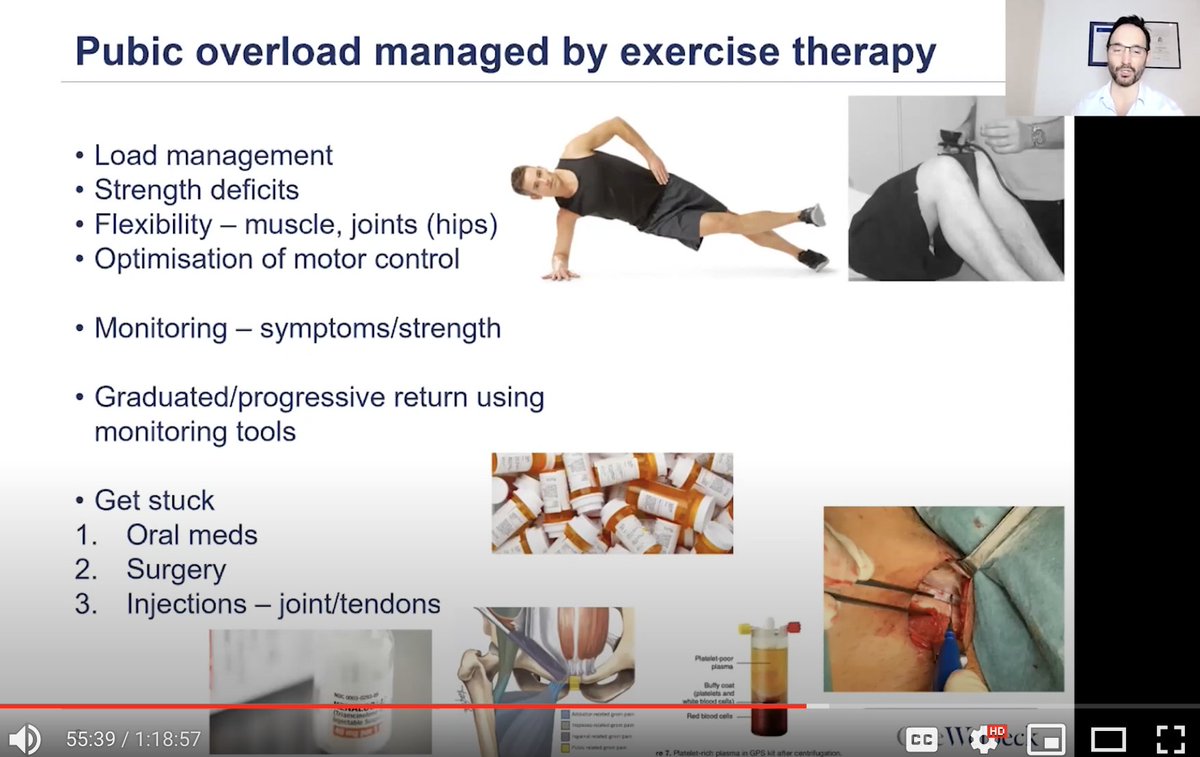 6/7I discussed injections for pubic overload - generally v low utility. Exercise therapy is the way forward. PRP does not cure everything and cortisone inj can cause serious harm. Nerve blocks may be useful for 1) Diagnostic utility 2) dampen pain response but less harm than PRP