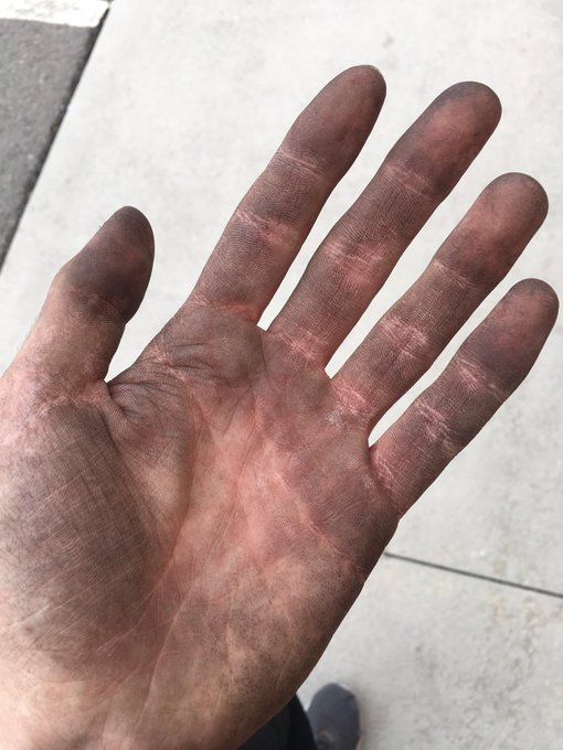 My hands look this this, so my family can be happy like this ❤️ https://t.co/DqL5mxY2IB