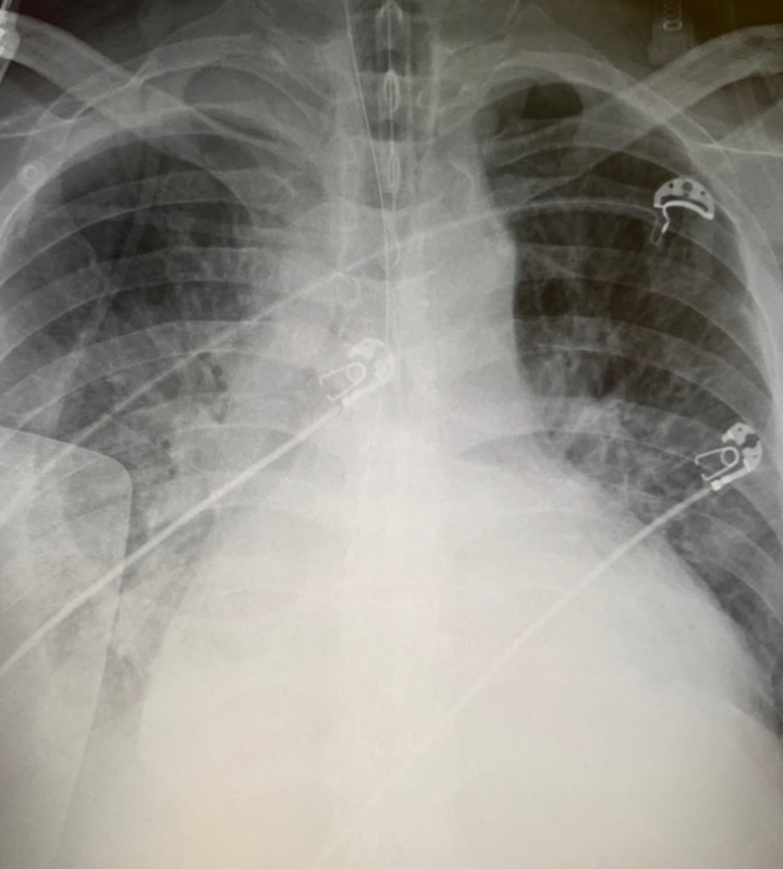 Looking forward to a robust series of presentations and discussions focused on the physiology, science, medicine, and business of Device innovations for acute and chronic Heart Failure. Join us for D-HF on a virtual platform this year! <a href="/BurkhoffMd/">Dan Burkhoff MD PhD</a> 

csi-congress.org/conferences-co…