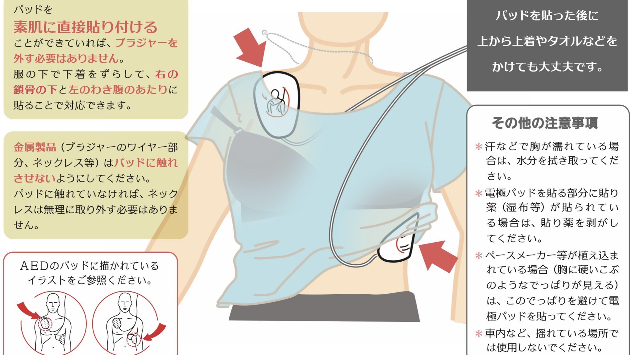 ট ইট র 怠惰に暮らしたいトド Aed持ってきました パッドを胸の2箇所に貼って 違う違う 女性の服を脱がす必要 ないから 端をめくりながらやって 絵の見様見真似で貼って パッドがブラジャーに触れないように 火傷する 違う違うブラ外す必要ない