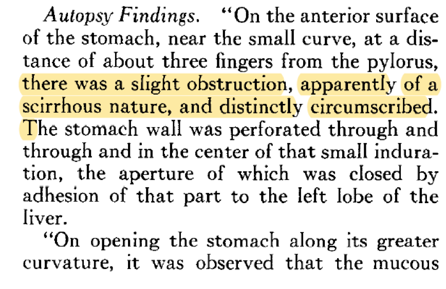 Autopsy findings proved him right and showed gastric tumor (T3N1M0, Stage IIIB, by current staging) with features similar to his father's tumor. His sister was also diagnosed with gastric tumor, thus raising a possibility of hereditary cancer.  https://tinyurl.com/2gcw563k&nbsp;