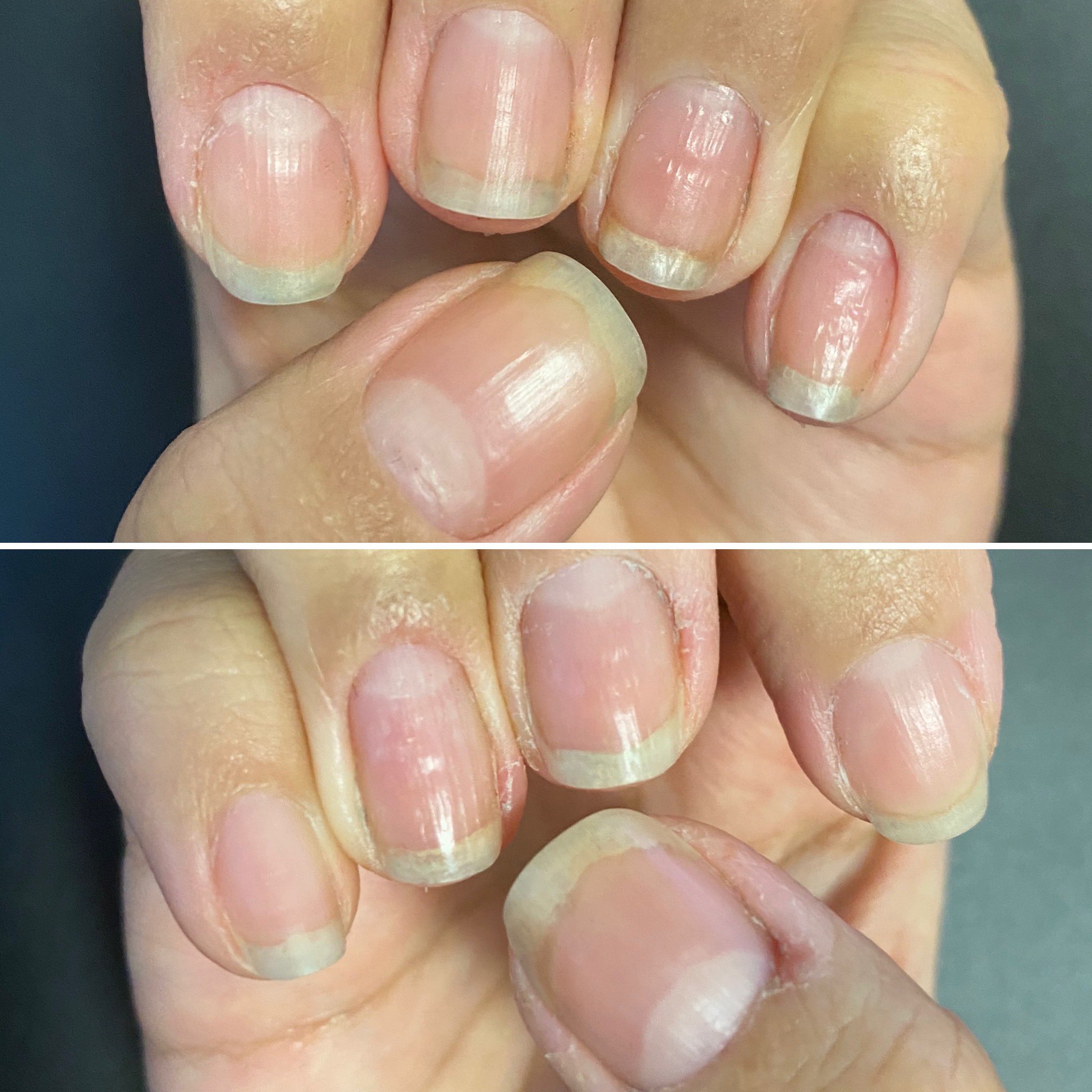 うに 21年2月11日 育爪112日目 1週間ぶりに素爪になりました 先週よりイエローラインガタガタになってる気がする T Co Jq6ev5zkto Twitter