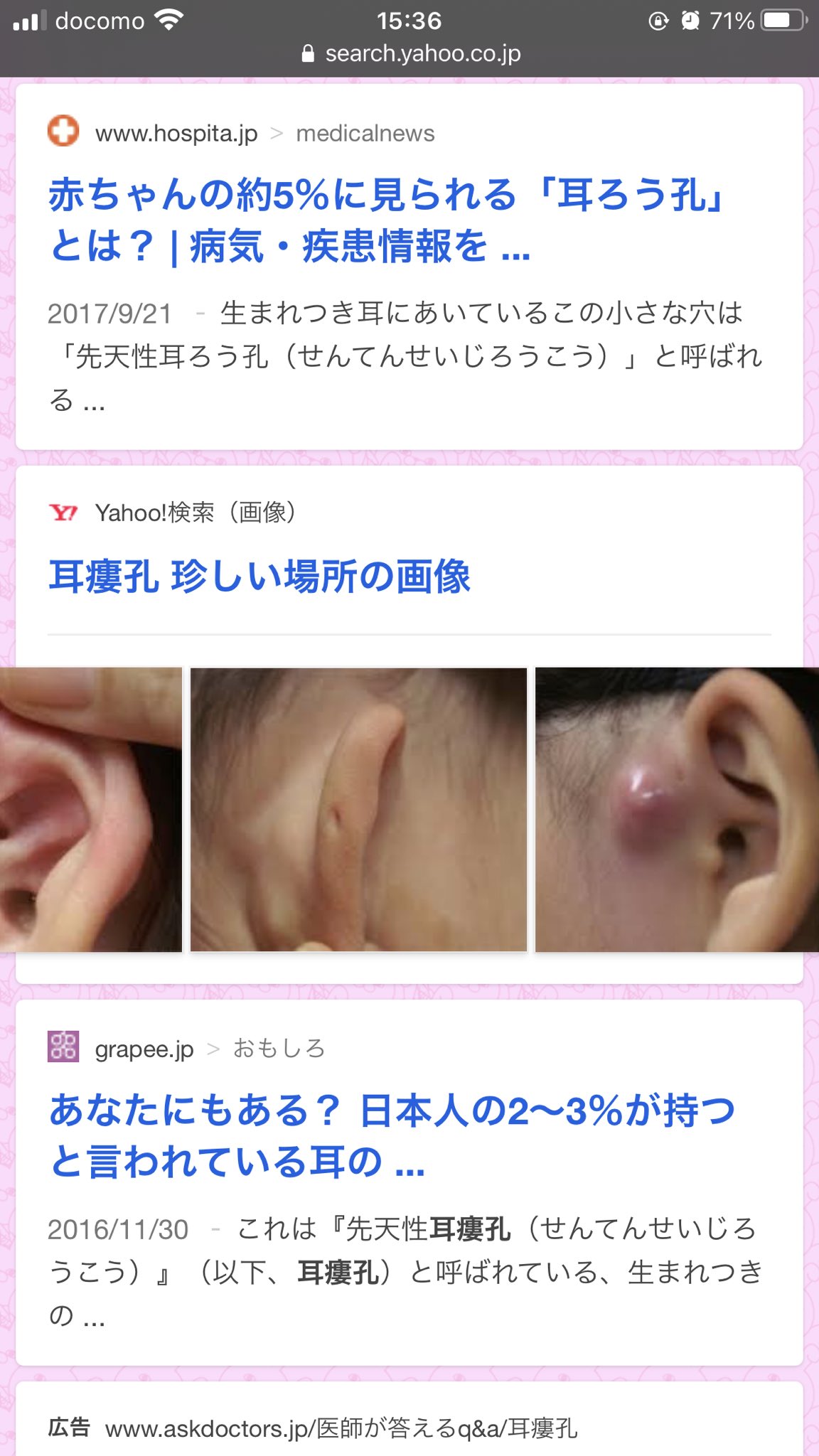 𝕄𝔸ℝ𝕀ℂℍ𝕀 生まれた時から長男の耳に穴が開いてたんだけど それがまさか病気だとは思いもしなかった 幸い何も無く過ごしてきたからいいけどこれで炎症とかしてたら手術も必要な病気で本当びっくり 何事もなくここまで大きくなってくれてありがとう
