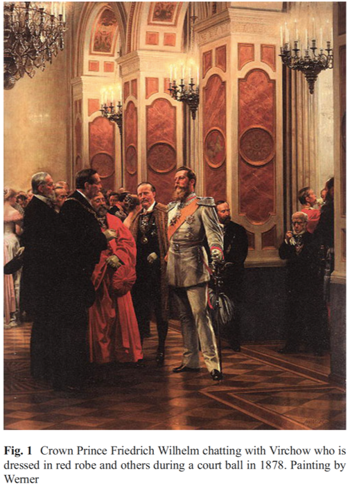 Rudolf Virchow, father of the cellular pathology, was known for his expertise in microscopic examination (here dressed in red robe and talking with Prince, in 1878). After microscopic examination, he diagnosed it as 'pachydermia verrucosa laryngis' with no evidence of malignancy.