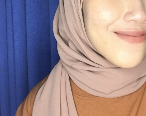 Jadi aku mau sedikit crita nih, ngga tau kenapa aku tu paling sebel kalau mukaku ada jerawatnya jadi kayak risih aja gitu. Aku udh nyoba bbrp serum dan kali ini aku beneran nemuin serum yang cocok utk mukaku ini. Ini foto before-afterku ya