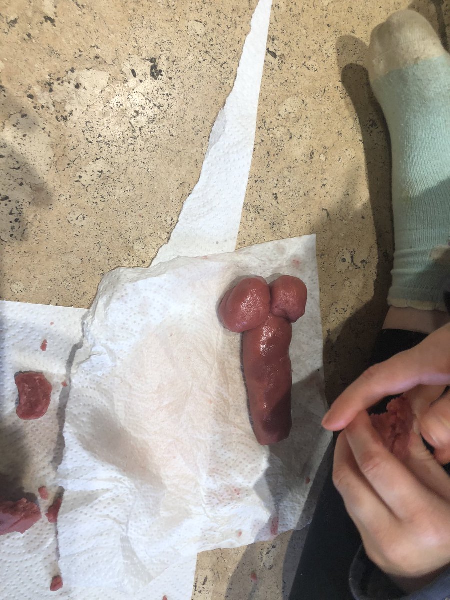 What are you making Alice?  
A bone mummy,please can you send it to my art teacher? 
Jessie - “how do I make that Alice?” Alice “first you get the big fat sausage then make the balls” #bonegate