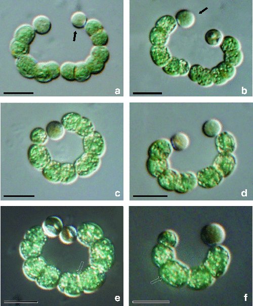 Phylogenomic analysis of the haloalkaliphilic cyanobacterium Anabaenopsis elenkinii, a resident of soda lakes, in #IJSEM
doi.org/10.1099/ijsem.…