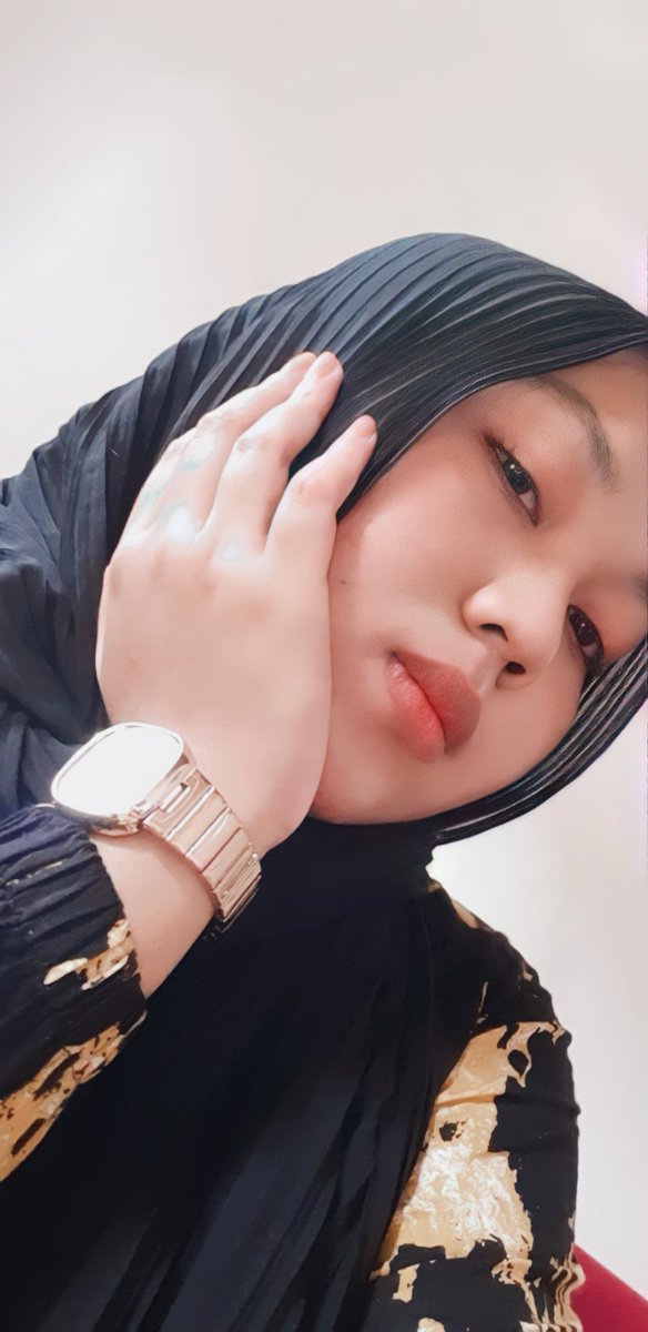 Dan ini kondisi kulitku yg sekarang, semoga bermanfaat yah Before afternya guys  #scarlettserum  #skincare  #scarlettacne  #scarlettwhitening